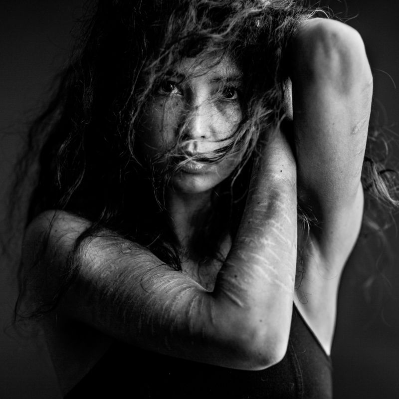 beauty, female, woman, eyes, black, white, studio, portrait, canon, godox, hair, nose, lips, scars, strong J e s sphoto preview