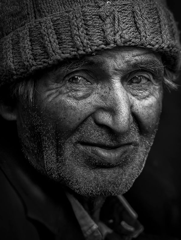 آلزایمرphoto preview