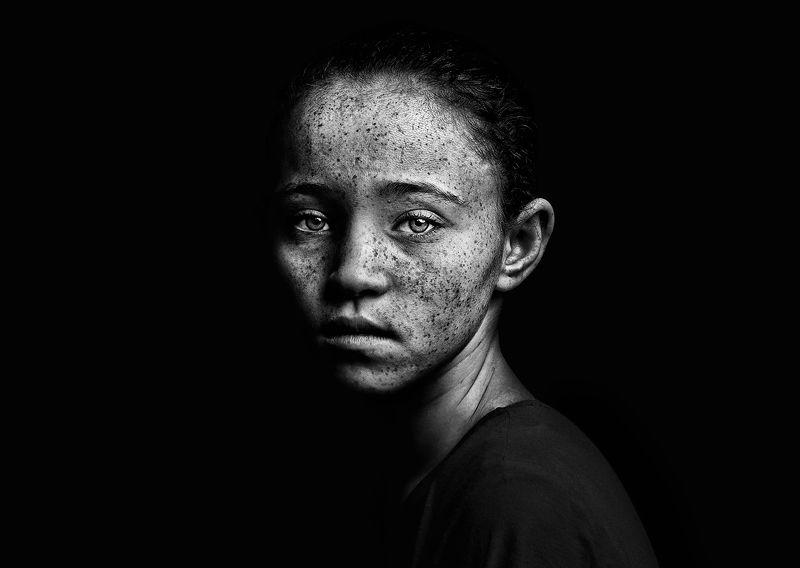 Norbanophoto preview