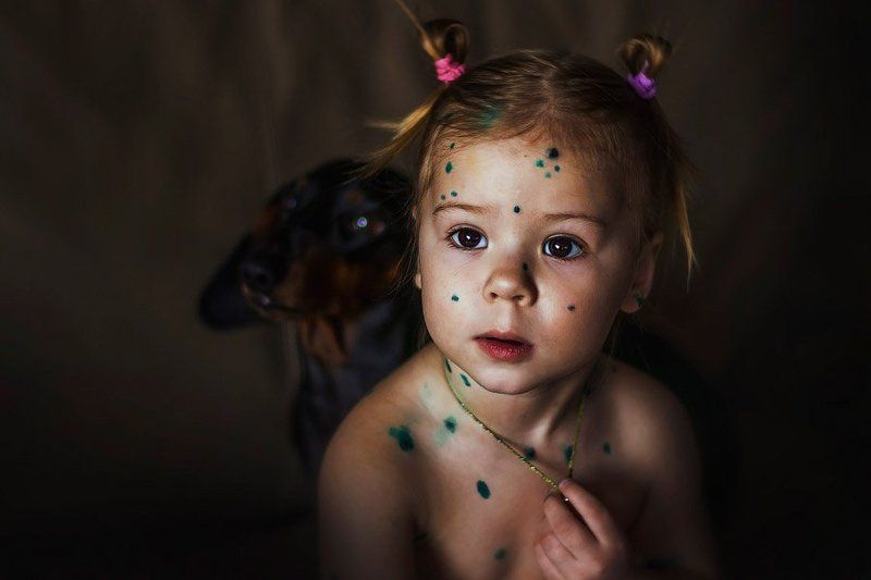 Ветрянкаphoto preview