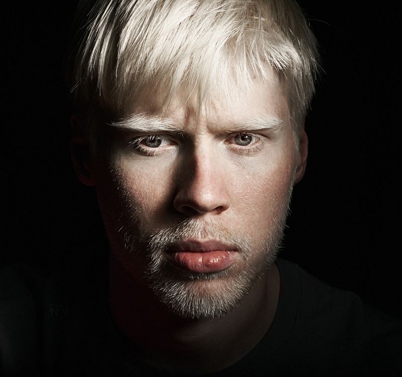 Albino Albinophoto preview