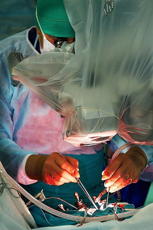врач, мозг, бурденко, клиника, операция, свет, руки, кровь, Один день из жизни операционного блока НИИ нейрохирургии им. акад. Н.Н. Бурденко РАМНphoto preview