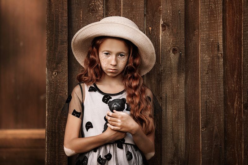 портрет, витилиго, модель, дети Дианаphoto preview