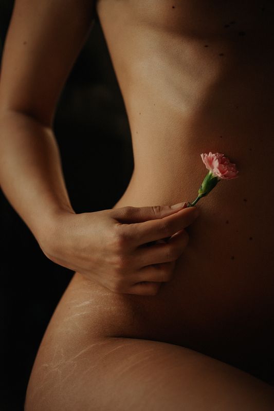 stretch marks, history, flower, hands Skin historyphoto preview