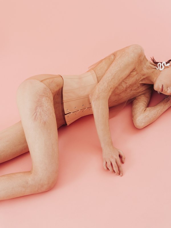 Refractoryphoto preview