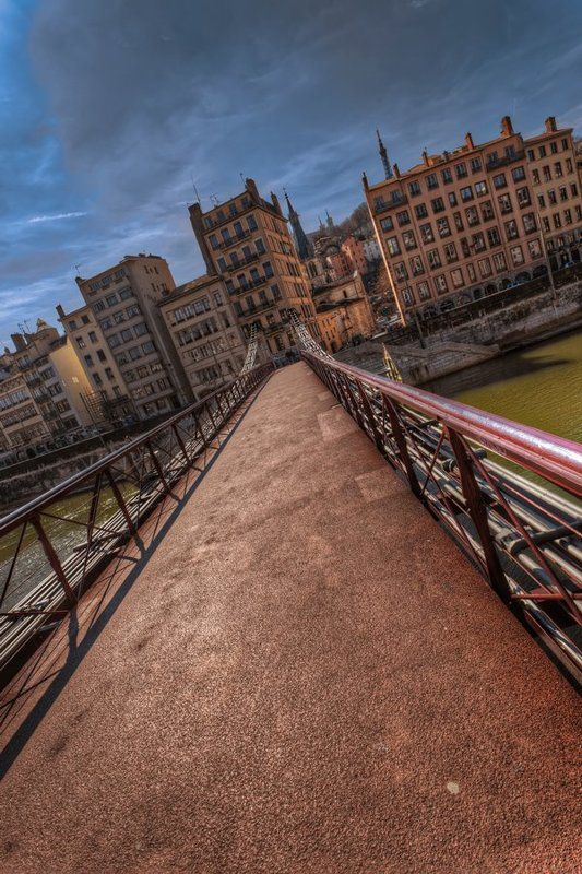 The other sidephoto preview