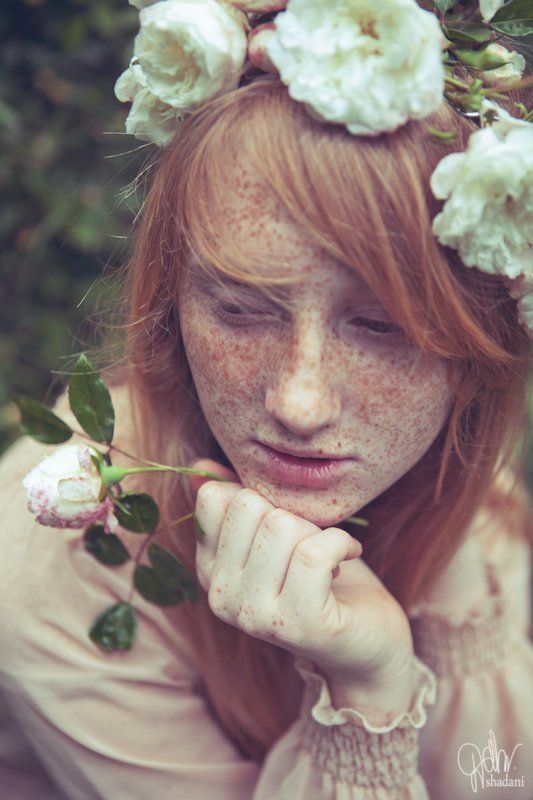 éphélidephoto preview