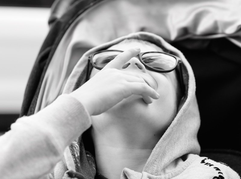 черно-белое, ребенок, мальчик, смех, счастье Когда счастлив от того, что сломал руку и не нужно идти в детский садphoto preview