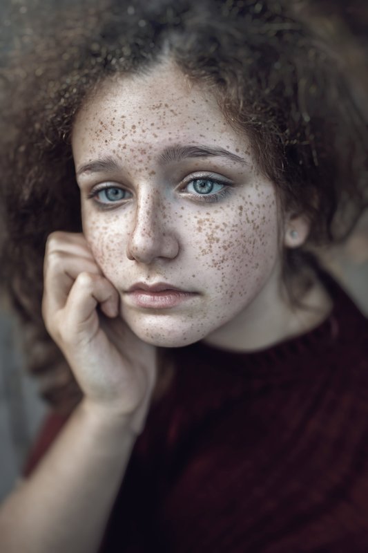 freckles freckle beautiful Freckles Beautyphoto preview