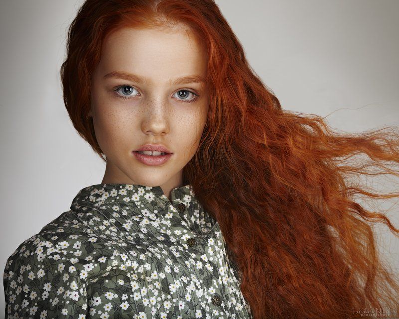 Альбинаphoto preview