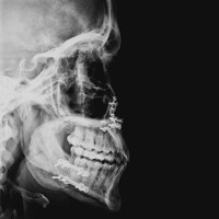 Portrait of a photographer (avatar) Althr3x